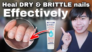 How to HEAL DRY amp BRITTLE NAILS effectively  My nursing interventions [upl. by Nemad]