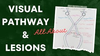 Visual Pathway and Lesions  Special Senses  Eye Physiology [upl. by Haramat]