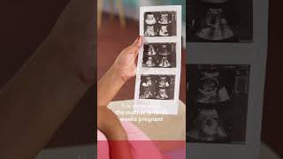 What is Fetal Echocardiography  Genesis Foundation  FAQ [upl. by Aria]