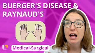 Buergers Disease and Raynauds  MedicalSurgical  Cardiovascular System  LevelUpRN [upl. by Nehgam]