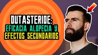 Dutasteride Para La Alopecia Androgenética [upl. by Jaqitsch]