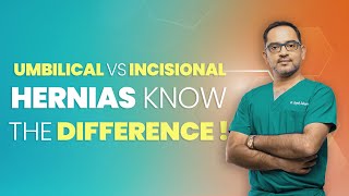 What is an Umbilical and Incisional hernia  Dr Deepak Subramanian [upl. by Kingston]