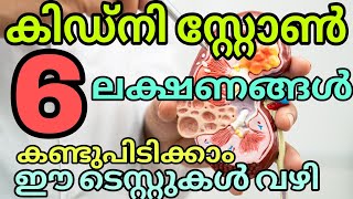 Kidney stone symptoms malayalam  Lab test for kidney stone kidney kidneyhealth labtest [upl. by Bernat]