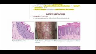 Pathoma Chapter 19 Skin Pathology Complete [upl. by Erapsag]