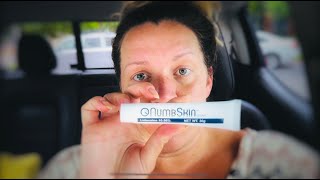 160 Hours of Electrolysis Facial Hair Removal How to prepare for your treatment  PCOS Hirsutism [upl. by Vonnie]