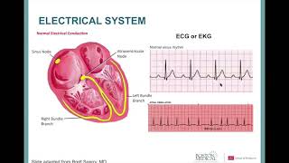 Cardiac Amyloidosis A Patient’s Perspective [upl. by Ecnedac]