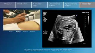 Key screening views of the fetal heart  Part 6  Vessel view [upl. by Angelina]