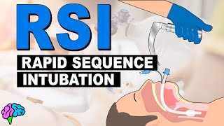 What is Rapid Sequence Intubation RSI [upl. by Illib]