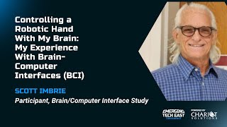 Controlling a Robotic Hand With My Brain My Experience  Scott Imbrie [upl. by Notyep]