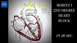 Mobitz I 2nd Degree Heart Block Animation and ECG Shorts [upl. by Heisel]