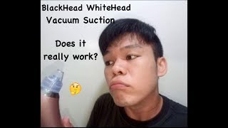 BlackWhiteHeads Pore Vacuum Suction RT8080 Beauty skin care Specialist Tons Try It [upl. by Kciredohr988]