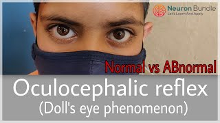 Doll’sEyeReflex Vestibulo Ocular reflex Normal amp ABnormal MADEEASY medicine neurology [upl. by Sumedocin165]