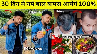 30 दिन में Hair Regrowth ampThin To Thick Hair Challenge 100  Results Hair Growth Tips Dhru Rao [upl. by Xavier]