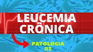 LEUCEMIA CRÔNICA  PATOLOGIA 3 [upl. by Ecirtac]