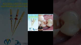 Endodontic Treatment upper Second Premolar single visit Endodontic treatment الكربولة endodontics [upl. by Hunfredo284]