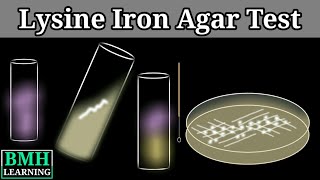 Lysine Iron Agar Test  Lysine Decarboxylase Test [upl. by Rivy954]