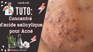 Acné poils incarnés kintos Fais cette base brute d’acide salicylique pour booster tes cosmétiques [upl. by Nolrah]