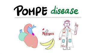 Pompe Disease with a mnemonic  Glycogen Storage Diseases [upl. by Eniawd249]