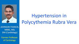 Hypertension in polycythemia rubra vera [upl. by Entruoc]