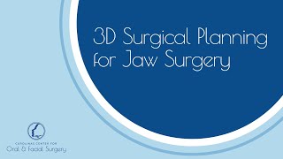 3D Surgical Planning for Jaw Surgery  Short [upl. by Bergmann]