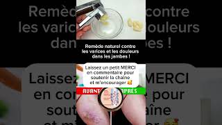 Adieu Varices et Douleurs aux Jambes  Découvrez Ce Remède 100 Naturel [upl. by Wandy569]