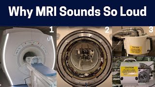 What Makes The Different MRI Scan Sounds Knocking to Rhythmic Chirping MRI Sounds Explained [upl. by Yenohtna]