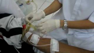 HEMODIALYSIS Procedure [upl. by Evatsug]