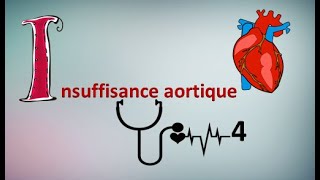 Comprendre linsuffisance aortique en 5 min ⏲️✔️ [upl. by Nrubua477]