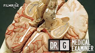 Dr G Medical Examiner  Season 3 Episode 3  Deadly Destination  Full Episode [upl. by Hsetirp]