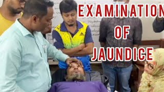 How to examine jaundice of a patient the easiest method to learn [upl. by Yetak646]