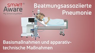 Beatmungsassoziierte Pneumonie Basismaßnahmen amp apparativtechnische Maßnahmen  Fortbildung Pflege [upl. by Vogel462]