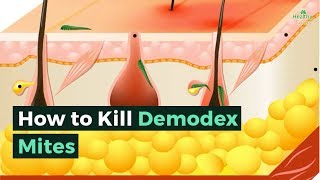 How to Kill Demodex Mites [upl. by Derna352]