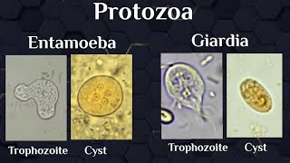 microscopical exam Protozoal trophozoites amp cysts [upl. by Haleemak]