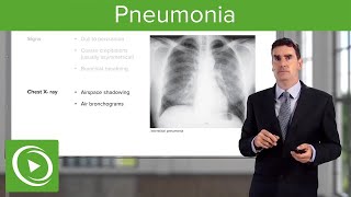 Pneumonia Types Classification Symptoms amp Management  Respiratory Medicine [upl. by Tynan]