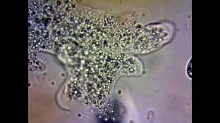 Amoeba amp Cytoplasmic Streaming [upl. by Sadnak]