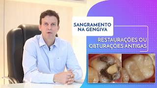 Sangramento na gengiva  Gengiva sangrando [upl. by Terrab]