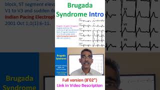 Brugada Syndrome [upl. by Lihka]