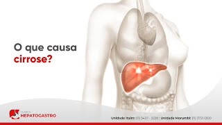 O que causa cirrose  Clínica Hepatogastro [upl. by Hilar]