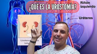 ¿QUÉ ES LA UROSTOMÍA [upl. by Grissel]