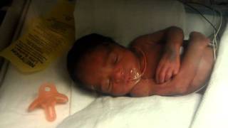 Baby Born at 30 weeks [upl. by Bouton]