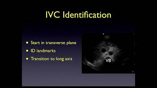 Inferior Vena Cava Ultrasound [upl. by Knut202]