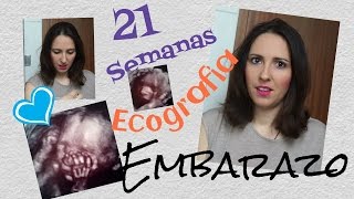 21 semanas embarazo  ecografia  bebearcoiris [upl. by Norvil]