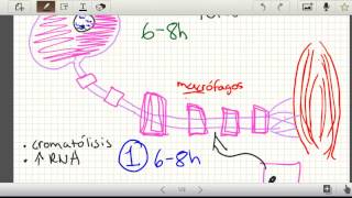 Regeneracion nerviosa snp Parte 2 Neuroapraxia Axonotmesis Neurotmesis Histologia [upl. by Assiren816]