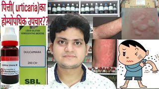 Urticaria Homeopathic medicine for Urticaria explain [upl. by Eiramllij]