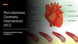 CPT Medicine Section Percutaneous Coronary Intervention PCI Coding [upl. by Davis]