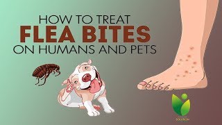 How to Treat Flea Bites on Humans and Pets  Home Remedies For Flea Bites on HumansDogs Treatment [upl. by Aniroc282]