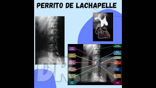 Columna lumbar perro LaChapelle medicina columna columnavertebral lumbar radiografia shorts [upl. by Allecsirp729]