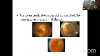 PG Orientation  Applied Anatomy Retina Vitreous  Dr M S Sunil [upl. by Osanna]