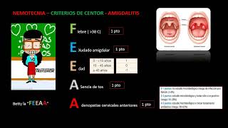 CRITERIOS DE CENTOR  AMIGDALITIS  NEMOTECNIA [upl. by Liatrice]