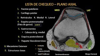 Resonancia Magnética de Rodilla Anatomía parte 2 [upl. by Ajile]